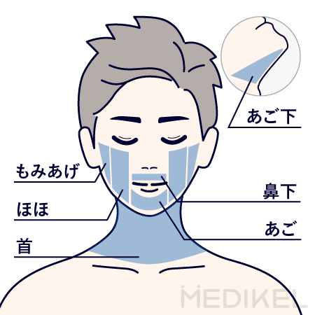 レジーナクリニックオムのヒゲ脱毛の施術範囲