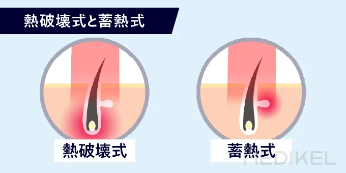 熱破壊式と蓄熱式の違い