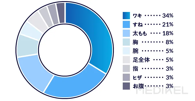 痛みを感じた部位のアンケート結果